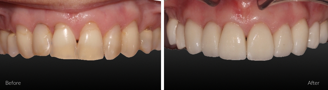 cosmetic dentistry examples