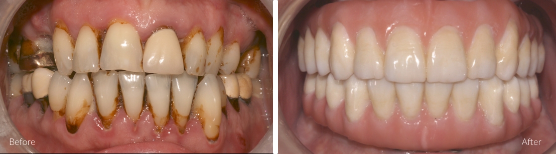 cosmetic dentistry examples